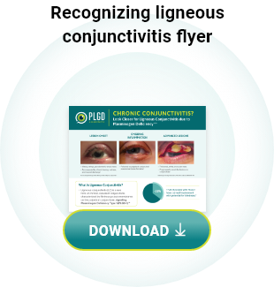 Chronic Conjunctivitis brochure